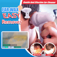 将图片加载到图库查看器,Ear Wax Easy Remover
