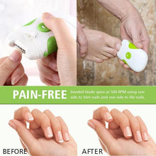 将图片加载到图库查看器,Electric nail trimmer