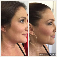 将图片加载到图库查看器,Slimming Strap