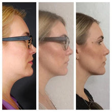 将图片加载到图库查看器，Slimming Strap
