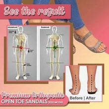 将图片加载到图库查看器，Premium orthopedic open-toed sandals
